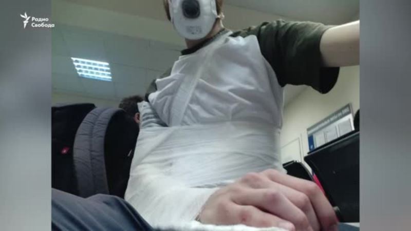 Россия: журналиста вызвали в МВД для составления протокола о неповиновении полицейскому, который сломал ему руку